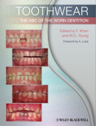 ĥİYίӢİToothwear- The ABC of the Worn Dentition